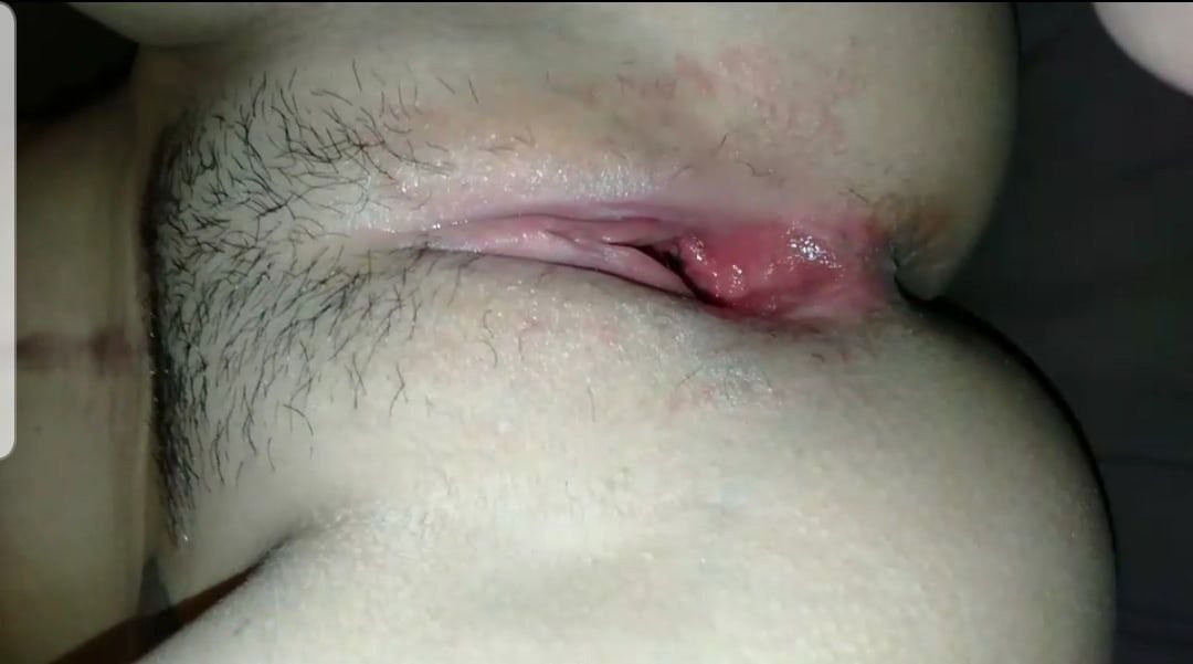 အဖုတ်ကြီးကဖူးယောင်